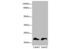 Western blot<br />
All lanes: FKBP11 antibody at 6ug/ml<br />
Lane 1 : Mouse spleen tissue<br />
Lane 2 : Mouse liver tissue<br />
Secondary<br />
Goat polyclonal to Rabbit IgG at 1/10000 dilution<br />
Predicted band size: 23,16 kDa<br />
Observed band s