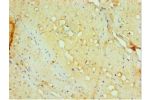Immunohistochemistry of paraffin-embedded human small intestine using CSB-PA878935ESR2HU at dilution 1:100