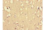 Immunohistochemistry of paraffin-embedded human brain tissue using CSB-PA878940LA01HU at dilution of 1:100