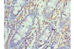 Immunohistochemistry of paraffin-embedded human rectum using CSB-PA878942ESR1HUat dilution 1:100