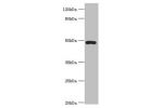 All lanes:Actin-related protein 3B antibody at 8ug/ml+HepG2 whole cell lysate<br />
Secondary<br />
Goat polyclonal to rabbit at 1/10000 dilution<br />
Predicted band size: 48,38,40 kDa<br />
Observed band size: 48 kDa<br />