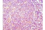 Immunohistochemistry of paraffin-embedded human tonsil using CSB-PA878955ESR2HU at dilution 1:100