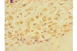 Immunohistochemistry of paraffin-embedded human placental tissue using CSB-PA878955LA01HU at dilution of 1:100