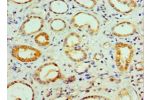 Immunohistochemistry of paraffin-embedded human kidney using CSB-PA880068ESR2HU at dilution 1:100