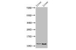Western Blot<br />
Positive WB detected in:Rat liver tissue,Mouse liver tissue<br />
All lanes:DDA1 antibody at 2.8