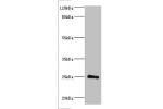 Western blot<br />
All lanes:Protein DGCR6L antibody at 2ug/ml+mouse brain tissue<br />
Secondary<br />
Goat polyclonal to rabbit at 1/10000 dilution<br />
Predicted band size: 25kDa<br />
Observed band size: 25kDa<br />