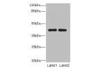 Western blot<br />
All lanes: CIPC antibody at 6ug/ml<br />
Lane 1 : A431 whole cell lysate<br />
Lane 2 : NIH/3T3 whole cell lysate<br />
Secondary<br />
Goat polyclonal to Rabbit IgG at 1/10000 dilution<br />
Predicted band size: 43 kDa<br />
Observed b