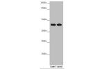 Western blot<br />
All lanes:CEP44 antibody at 6.92 ug/ml<br />
Lane 1 : Jurkat whole cell lysate<br />
Lane 2 : MCF7 whole cell lysate<br />
Secondary<br />
Goat polyclonal to rabbit IgG at 1/10000 dilution<br />
Predicted band size: 44 kDa<br />
Observe