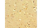 Immunohistochemistry of paraffin-embedded human brain tissue using CSB-PA880159HA01HU at dilution of 1:100