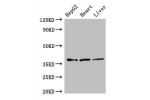 Western Blot<br />
Positive WB detected in:HepG2 whole cell lysate,Rat heart tissue,Rat liver tissue<br />
All lanes:ELOVL4 antibody at 3