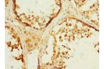 Immunohistochemistry of paraffin-embedded human testis tissue CSB-PA880929ESR1HU at dilution 1:100