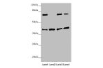 Western blot<br />
All lanes:DSN1 antibody at 2.19 ug/ml<br />
Lane 1 : Hela whole cell lysate<br />
Lane 2 : Mouse skeletal muscle tissue<br />
Lane 3 : Mouse lung tissue<br />
Lane 4 : Mouse stomach tissue<br />
Secondary<br />
Goat polyclonal to rabbit