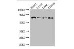 Western Blot<br />
Positive WB detected in:Mouse heart tissue,Mouse liver tissue,Mouse lung tissue,Mouse kidney tissue<br />
All lanes: FZD8 antibody at 2.7ug/ml<br />
Secondary<br />
Goat polyclonal to rabbit IgG at 1/50000 dilution<br />
Predicted band 