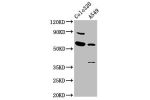 Western Blot<br />
Positive WB detected in:Colo320 whole cell lysate,A549 whole cell lysate<br />
All lanes:EBF3 antibody at 5.6