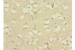 Immunohistochemistry of paraffin-embedded human brain tissue CSB-PA880979LA01HU at dilution 1:100
