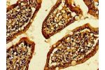 Immunohistochemistry of paraffin-embedded human small intestine tissue using CSB-PA880981LA01HU at dilution of 1:100