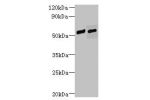 Western blot<br />
All lanes: FAM124B antibody at 12ug/ml<br />
Lane 1 : Hela whole cell lysate<br />
Lane 2 : K562 whole cell lysate<br />
Secondary<br />
Goat polyclonal to Rabbit IgG at 1/10000 dilution<br />
Predicted band size: 51,32 kDa<br />
Observ