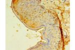 Immunohistochemistry of paraffin-embedded human skin using CSB-PA880987ESR2HU at dilution 1:100