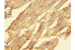 Immunohistochemistry of paraffin-embedded human skeletal muscle tissue using CSB-PA880988LA01HU at dilution of 1:100