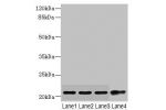 Western blot<br />
All lanes: CSRP2 antibody at 5.74ug/ml<br />
Lane 1 : Mouse lung tissue<br />
Lane 2 : A375 whole cell lysate<br />
Lane 3 : A549 whole cell lysate<br />
Lane 4 : HepG-2 whole cell lysate<br />
Secondary<br />
Goat polyclonal to rabbit 
