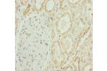 Immunohistochemistry of paraffin-embedded human kidney tissue using CSB-PA881003ESR1HU at dilution 1:100