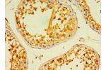 Immunohistochemistry of paraffin-embedded human testis using CSB-PA881011ESR2HU at dilution 1:100
