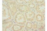 Immunohistochemistry of paraffin-embedded human kidney tissue using CSB-PA881016ESR2HU at dilution 1:100