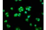 Immunofluorescence staining of HepG2 cells with CSB-PA881032LA01HU at 1:66,counter-stained with DAPI. The cells were fixed in 4% formaldehyde, permeabilized using 0.2% Triton X-100 and blocked in 10% normal Goat Serum. The cells were then incubated with t
