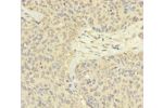 Immunohistochemistry of paraffin-embedded human ovarian cancer using CSB-PA882059LA01HU at dilution 1:100