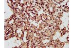IHC image of CSB-PA882066LA01HU diluted at 1:300 and staining in paraffin-embedded human lung tissue performed on a Leica BondTM system. After dewaxing and hydration, antigen retrieval was mediated by high pressure in a citrate buffer (pH 6.0). Section wa