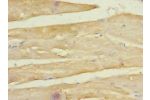 Immunohistochemistry of paraffin-embedded human skeletal muscle tissue CSB-PA882067ESR2HU at dilution 1:100