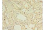 Immunohistochemistry of paraffin-embedded human kidney tissue using CSB-PA882080LA01HU at dilution of 1:100
