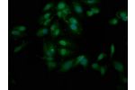 Immunofluorescence staining of Hela cells with CSB-PA882120LA01HU at 1:200,counter-stained with DAPI. The cells were fixed in 4% formaldehyde, permeabilized using 0.2% Triton X-100 and blocked in 10% normal Goat Serum. The cells were then incubated with t