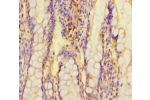 Immunohistochemistry of paraffin-embedded human small intestine tissue using CSB-PA882136LA01HU at dilution of 1:100