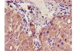 Immunohistochemistry of paraffin-embedded human liver tissue using CSB-PA882143LA01HU at dilution of 1:100