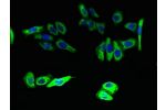 Immunofluorescent analysis of HepG2 cells using CSB-PA882144LA01HU at a dilution of 1:100 and Alexa Fluor 488-congugated AffiniPure Goat Anti-Rabbit IgG(H+L)