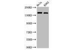 Western Blot<br />
Positive WB detected in:Hela whole cell lysate,K562 whole cell lysate<br />
All lanes:CDK12 antibody at 2