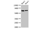 Western Blot<br />
Positive WB detected in:Rat heart tisseu,Mouse heart tissue<br />
All lanes:FASTKD2 antibody at 8