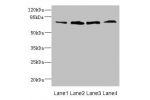 Western blot<br />
All lanes: DARS2 antibody at 16ug/ml<br />
Lane 1 : Mouse heart tissue<br />
Lane 2 : Mouse liver tissue<br />
Lane 3 : Mouse brain tissue<br />
Lane 4 : Mouse skeletal muscle tissue<br />
Secondary<br />
Goat polyclonal to rabbit IgG a