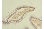 Immunohistochemistry of paraffin-embedded human small intestine tissue using CSB-PA882164LA01HU at dilution of 1:100