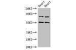 Western Blot<br />
Positive WB detected in:Rat heart tissue,Mouse heart tissue<br />
All lanes:Acss2 antibody at 4