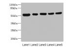 Western blot<br />
All lanes: ATXN10 antibody at 4.79ug/ml<br />
Lane 1 : A431 whole cell lysate<br />
Lane 2 : LO2 whole cell lysate<br />
Lane 3 : HepG-2 whole cell lysate<br />
Lane 4 : 293T whole cell lysate<br />
Lane 5 : Hela whole cell lysate<br />