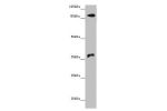 Western blot<br />
All lanes: DNMT3B antibody at 14 ug/ml+ Hela whole cell lysate<br />
Secondary<br />
Goat polyclonal to rabbit IgG at 1/10000 dilution<br />
Predicted band size: 96,94,87,81,89,95,78,82 kDa<br />
Observed band size: 96,37 kDa<br />