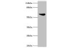 Western blot<br />
All lanes:Set1/Ash2 histone methyltransferase complex subunit ASH2 antibody at 2ug/ml+K562 whole cell lysate<br />
Secondary<br />
Goat polyclonal to rabbit at 1/10000 dilution<br />
Predicted band size: 69,57,61 kDa<br />
Observed band