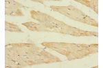 Immunohistochemistry of paraffin-embedded human skeletal muscle tissue CSB-PA883385LA01HU at dilution 1:100