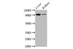 Western Blot<br />
Positive WB detected in:Mouse liver tissue,Mouse kidney tissue<br />
All lanes:DMGDH antibody at 6.7