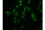 Immunofluorescence staining of Hela cells with CSB-PA883427LA01HU at 1:266,counter-stained with DAPI. The cells were fixed in 4% formaldehyde, permeabilized using 0.2% Triton X-100 and blocked in 10% normal Goat Serum. The cells were then incubated with t