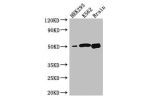 Western Blot<br />
Positive WB detected in:HEK293 whole cell lysate,K562 whole cell lysate,Mouse brain tissue<br />
All lanes: BTNL2 antibody at 3.2ug/ml<br />
Secondary<br />
Goat polyclonal to rabbit IgG at 1/50000 dilution<br />
Predicted band size: 51