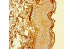 Immunohistochemistry of paraffin-embedded human skin tissue using CSB-PA883613HA01HU at dilution of 1:100