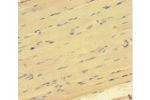 Immunohistochemistry of paraffin-embedded human skeletal muscle tissue using CSB-PA883616HA01HU at dilution 1:100